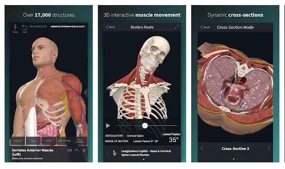 3D4Medical